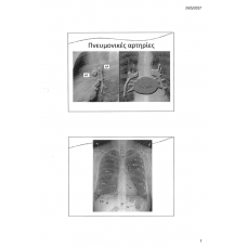 AKTINOLOGIKH APEIKONISH THWRAKOS 